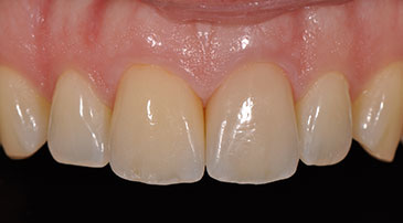 settimaB