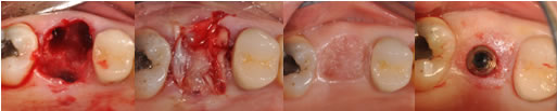 TOOTH-TRANSFORMER2