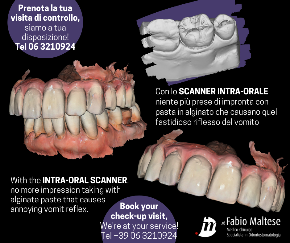 Scanner Intra-Orale per la scansione dell’arcata senza fastidi