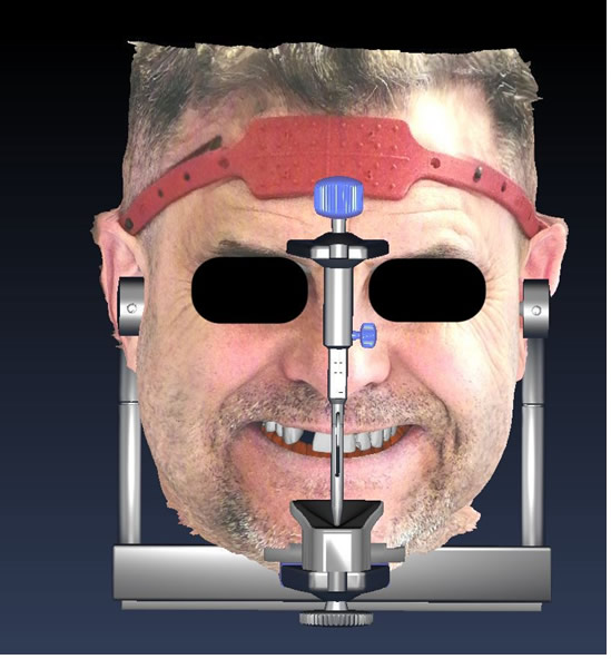 Scansione 3D del viso del paziente
